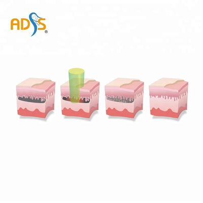 OEM / ODM Q Switch Yag Laser Penghilang Tato Mesin Garansi 2 Tahun