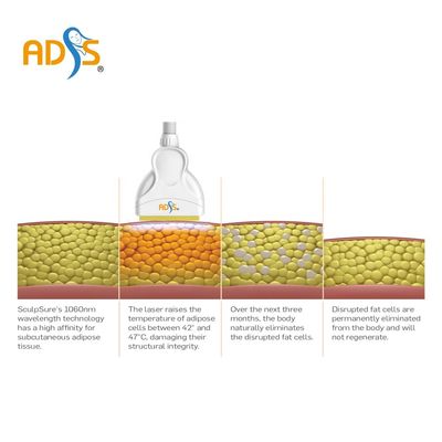 Mesin Pelangsing Cryolipolysis 1060nm 4 Menangani Mesin Pelangsing Laser Diode