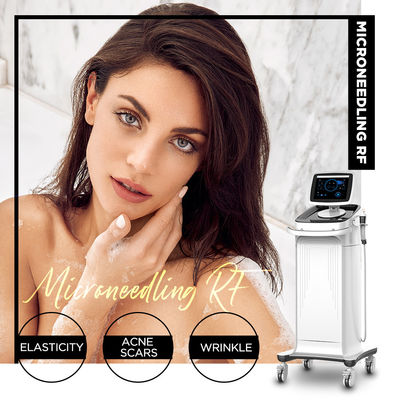 Mesin Microneedling RF Putih Stasioner Untuk Salon Spa
